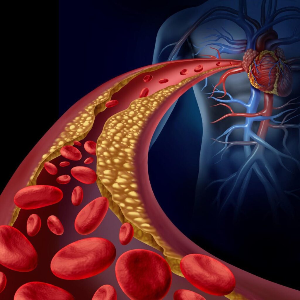 The Ideal Cholesterol Levels: What You Should Aim For