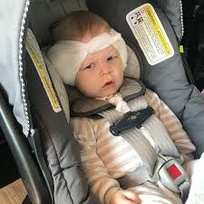 Babies 7 Months Can Get Life-Changing Cochlear Implants